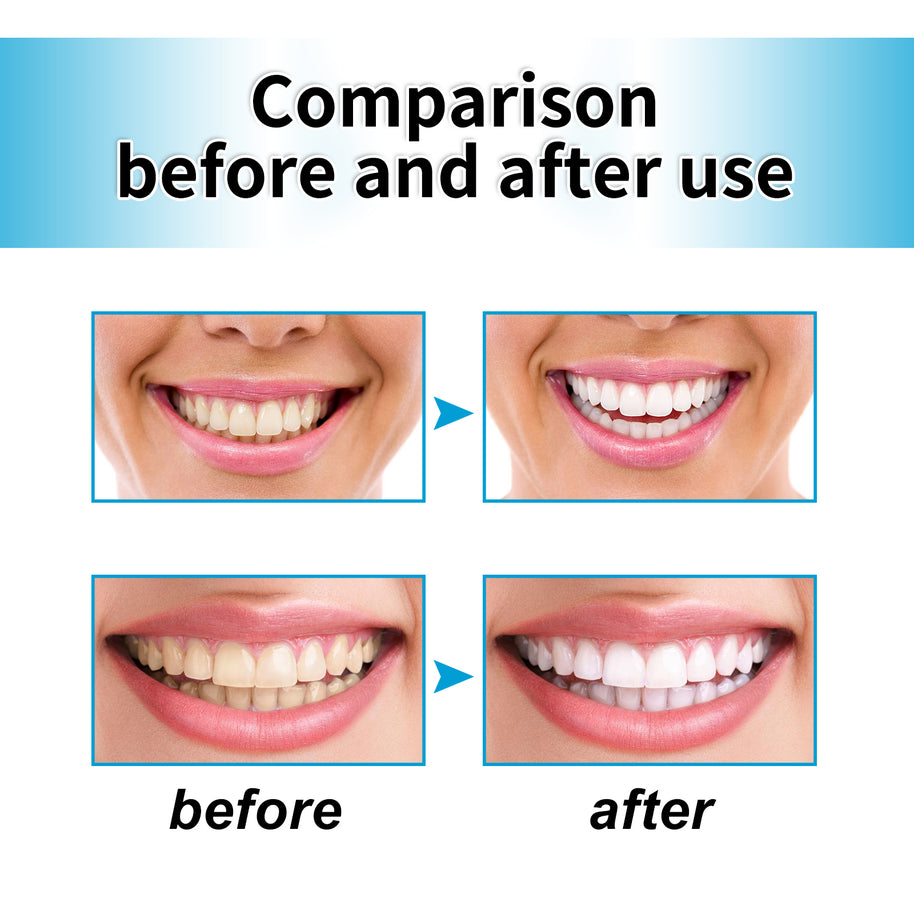 Whitening Tooth Powder - HaiyiBeauty