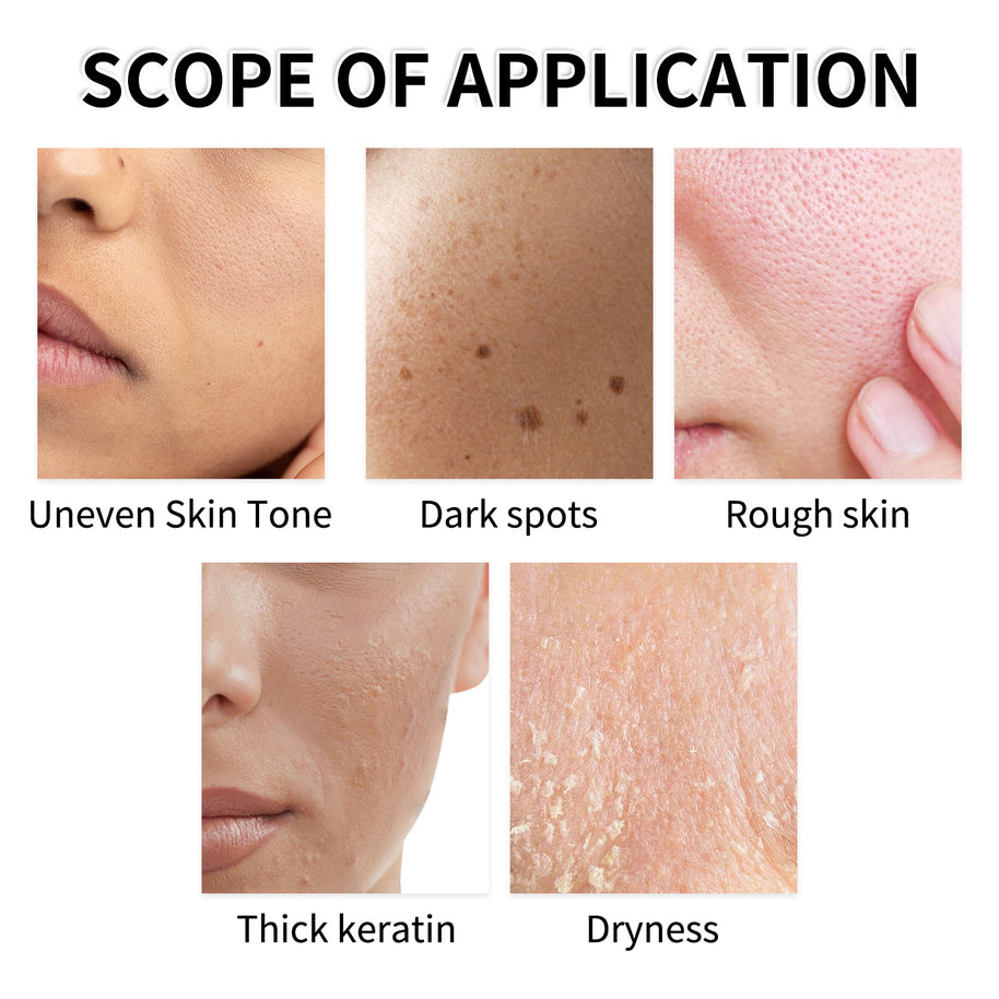 YILEST Yeast Exfoliating Lotion Toner - HaiyiBeauty