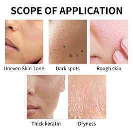 YILEST Yeast Exfoliating Lotion Toner - HaiyiBeauty