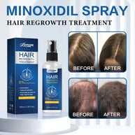 Spray de croissance capillaire au minoxidil LUNOON
