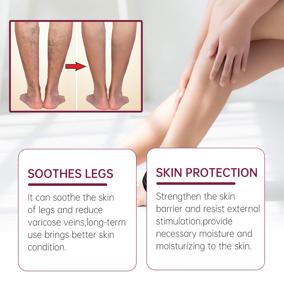 Varicose Vein Relief Cream - HaiyiBeauty