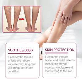 Varicose Vein Relief Cream - HaiyiBeauty