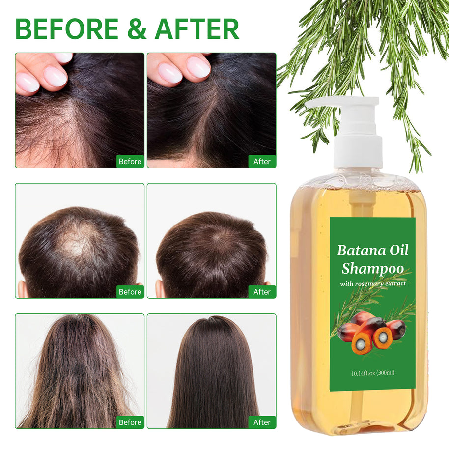 Batana Rosemary Oil Shampoo - HaiyiBeauty