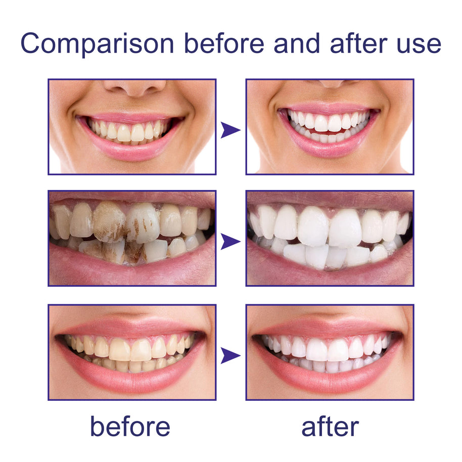 LUNOON V34 Toothpaste