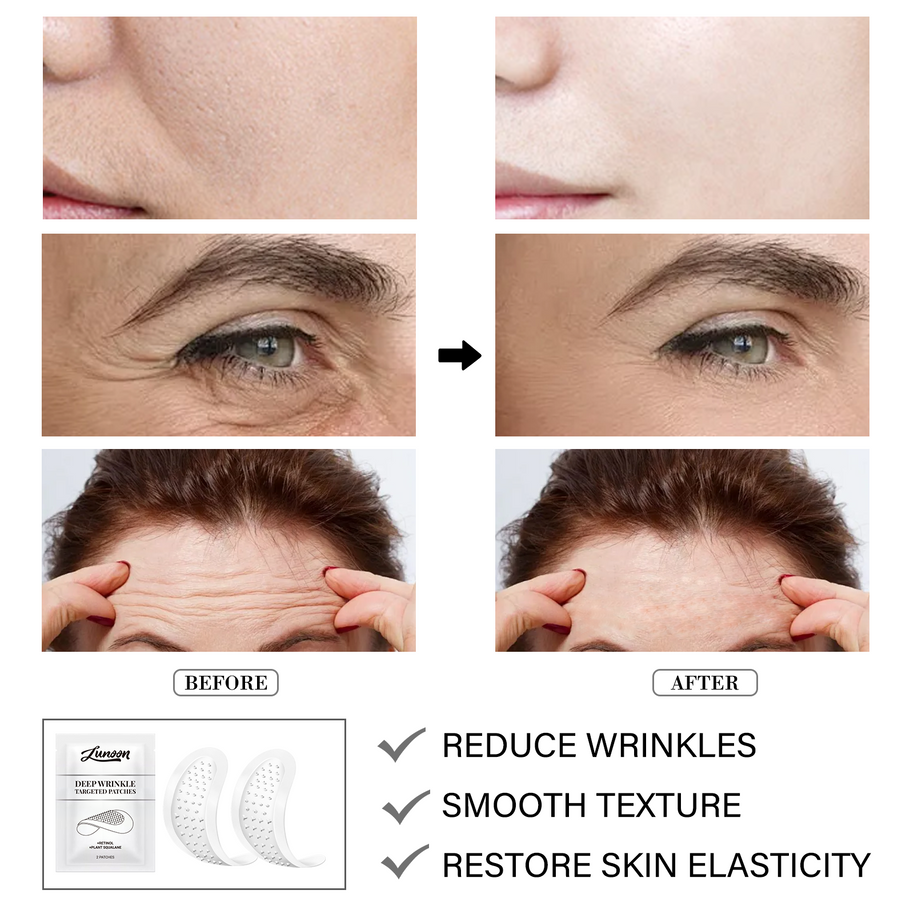 LUNOON Microneedle Fine Line Patch - HaiyiBeauty