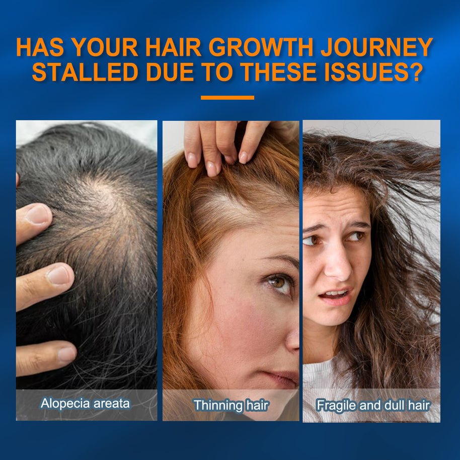 5% Minoxidil Biotin Foaming Agent - HaiyiBeauty