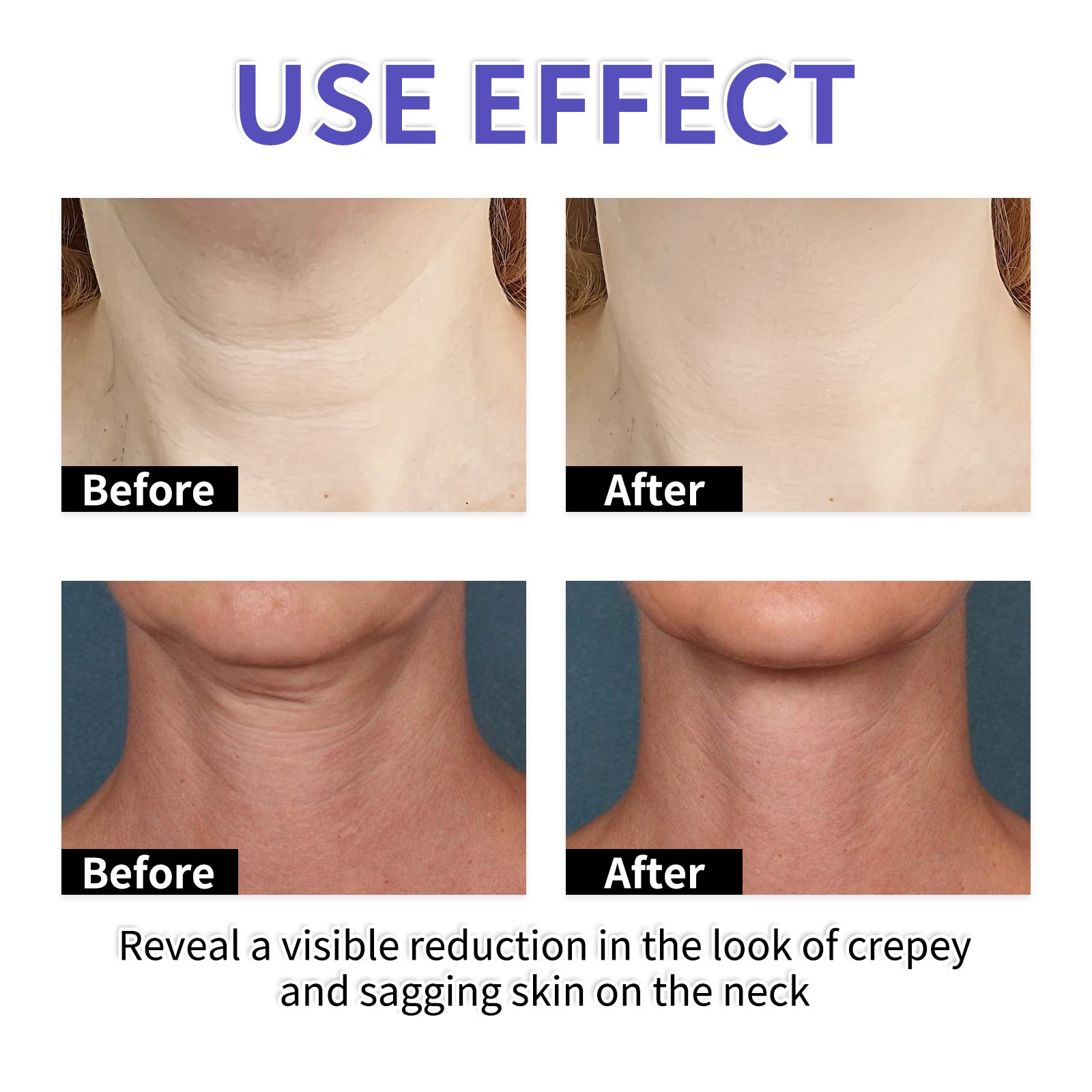 LUNOON Firming and Lifting Neck Cream