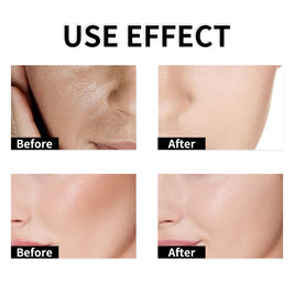 YILEST Yeast Exfoliating Lotion Toner - HaiyiBeauty