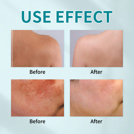 LUNOON Sunscreen Stick - HaiyiBeauty