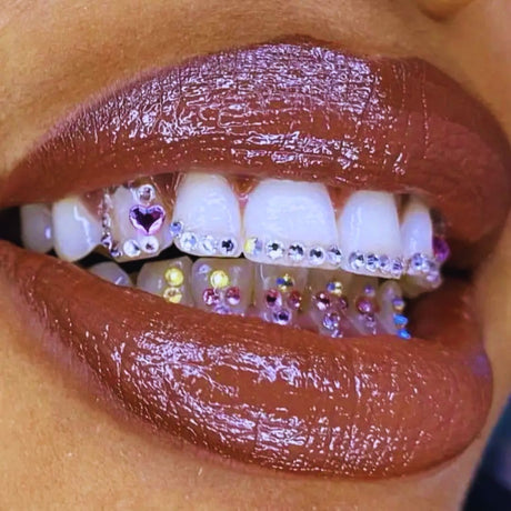 alt="Close-up of deep brown glossy lips framing jeweled teeth, with white and purple crystals on upper teeth, pink and yellow gems on lower teeth"