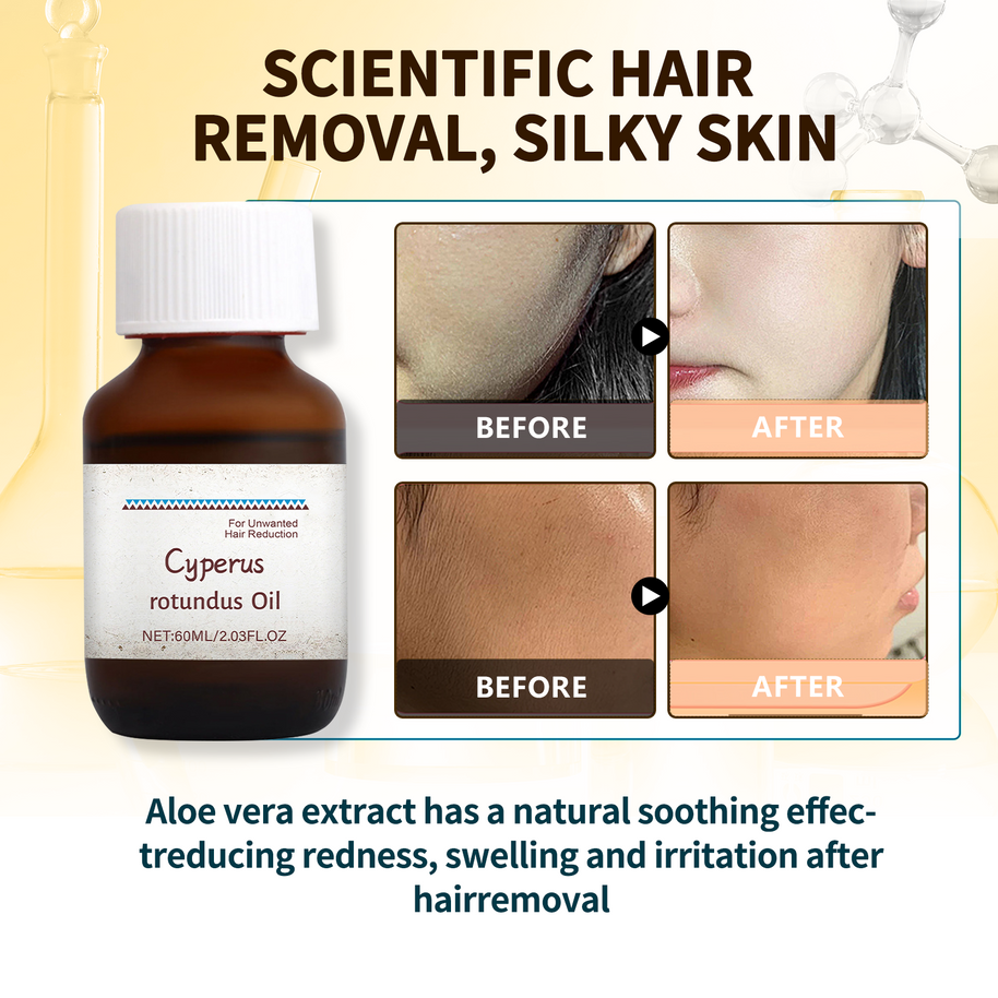 Cyperus Hair Removal Oil - HaiyiBeauty