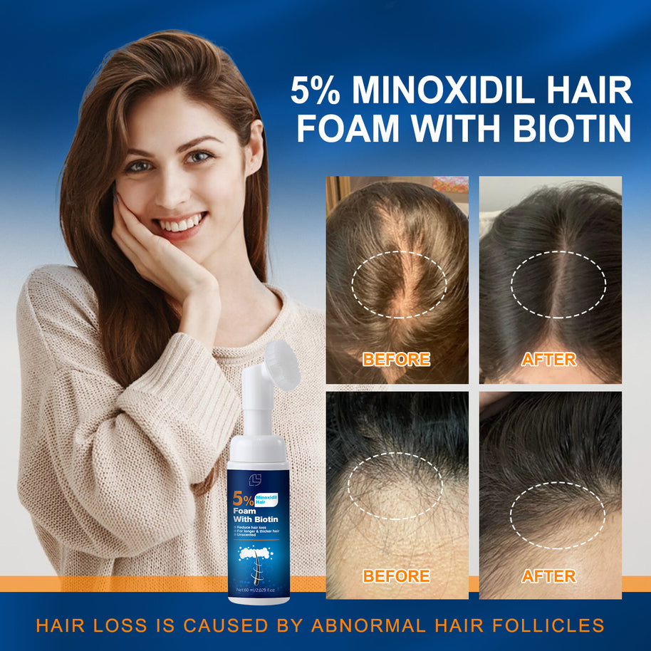 5% Minoxidil Biotin Foaming Agent - HaiyiBeauty