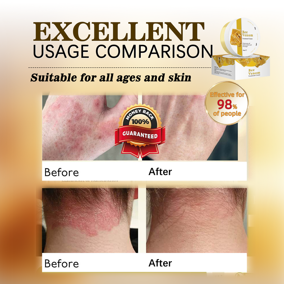 Bee Venom Skin Cream - HaiyiBeauty