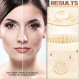 LUNOON Anti-Wrinkle Facial Serum - HaiyiBeauty