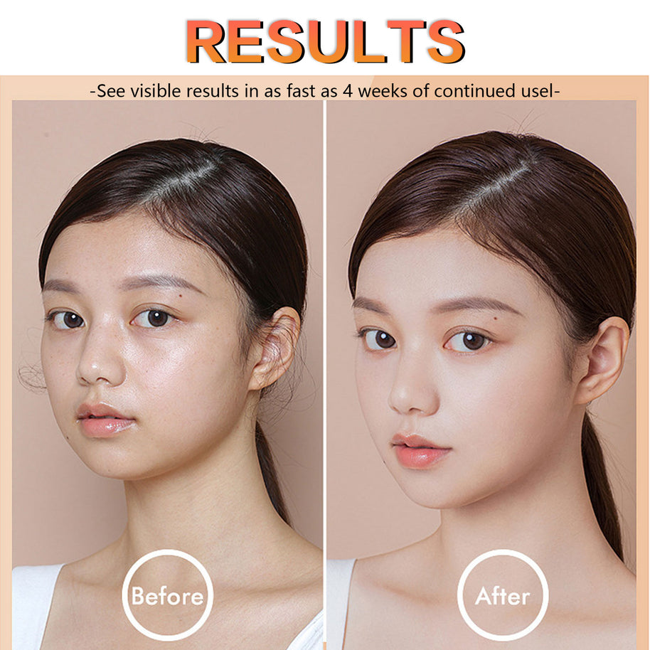 LUNOON Anti-Wrinkle Facial Serum - HaiyiBeauty