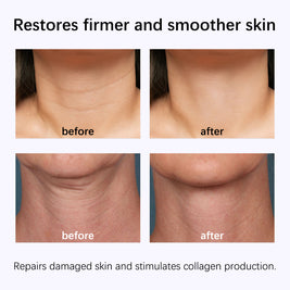 GROEI Snake Oil Neck Mask - HaiyiBeauty