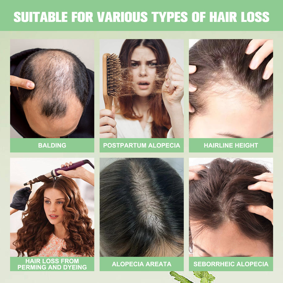 YILEST Rosemary Hair Growth Shampoo - HaiyiBeauty
