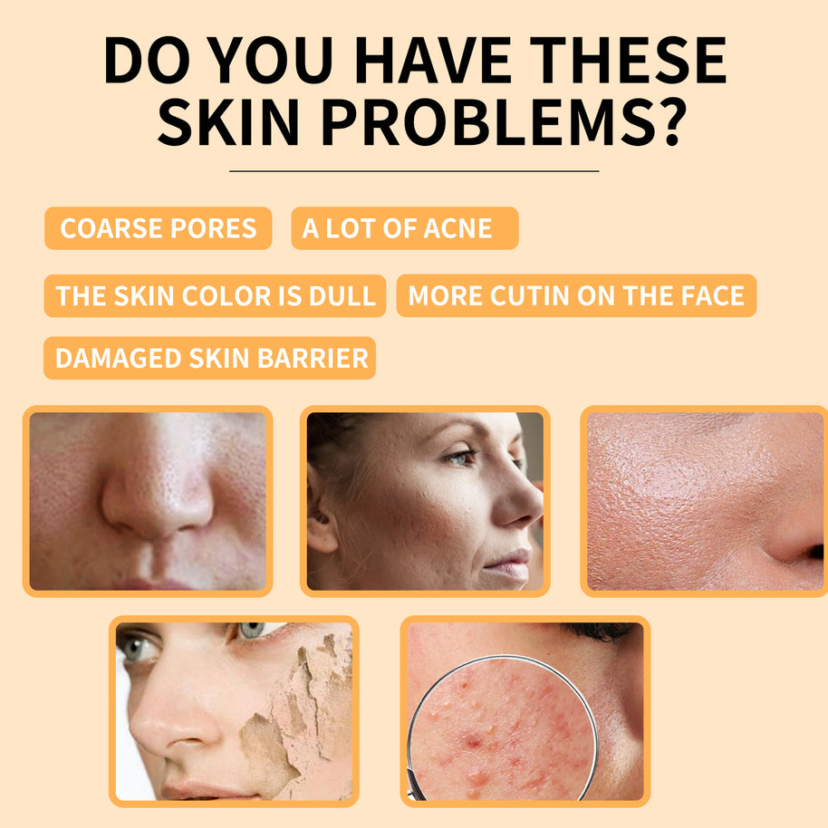 Glycolic Acid 7% Toning Solution - HaiyiBeauty
