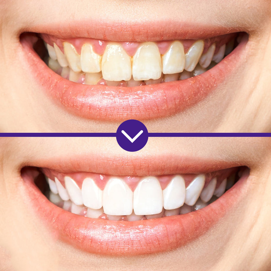 GROEI Tooth Cleaning Liquid - HaiyiBeauty
