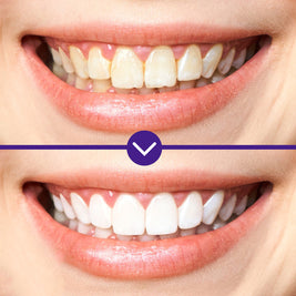GROEI Tooth Cleaning Liquid - HaiyiBeauty