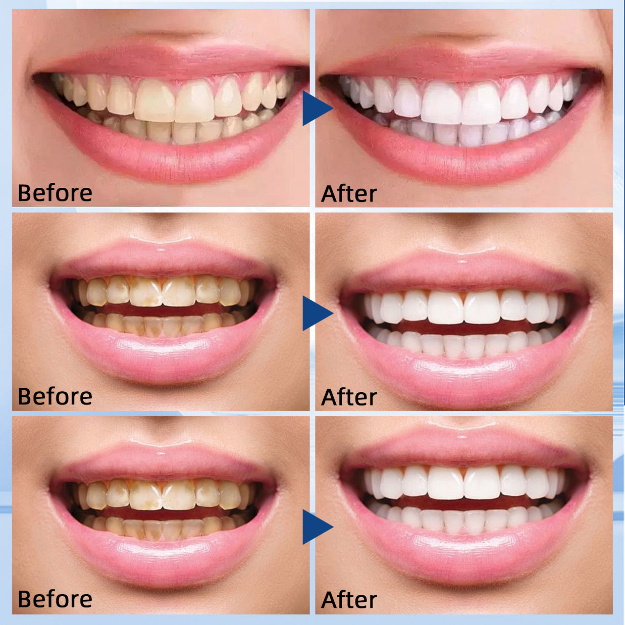 GROEI Hydroxyapatite Tooth Powder - HaiyiBeauty