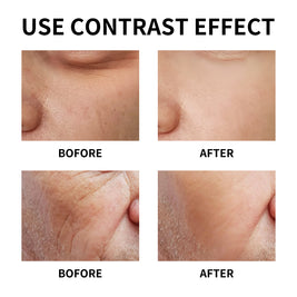 YILEST Men's Moisturizing Cream - HaiyiBeauty