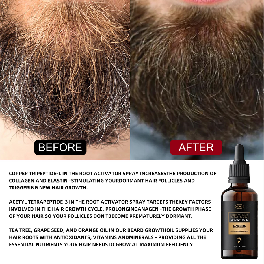 SOUG Beard Growth Oil - HaiyiBeauty
