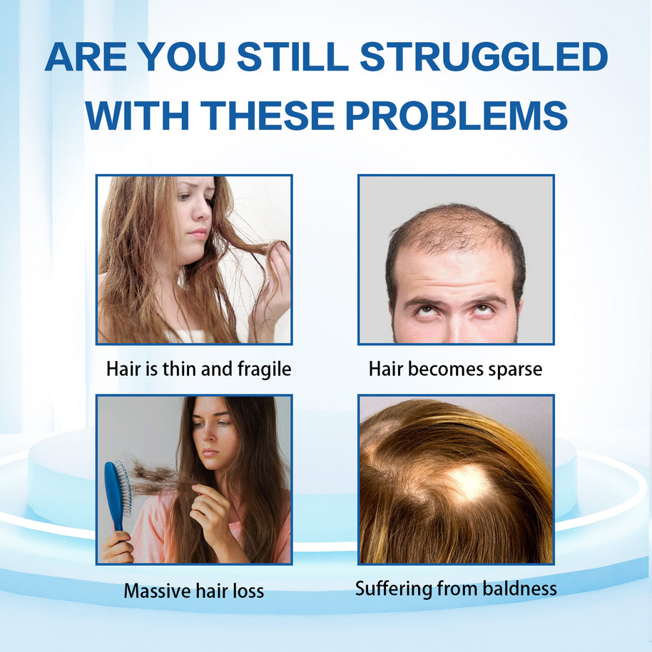 LUNOON Minoxidil Hair Growth Spray - HaiyiBeauty