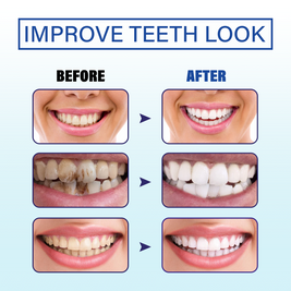 LUNOON Tooth Powder - HaiyiBeauty