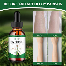 GROEI Hair Removal Essence - HaiyiBeauty