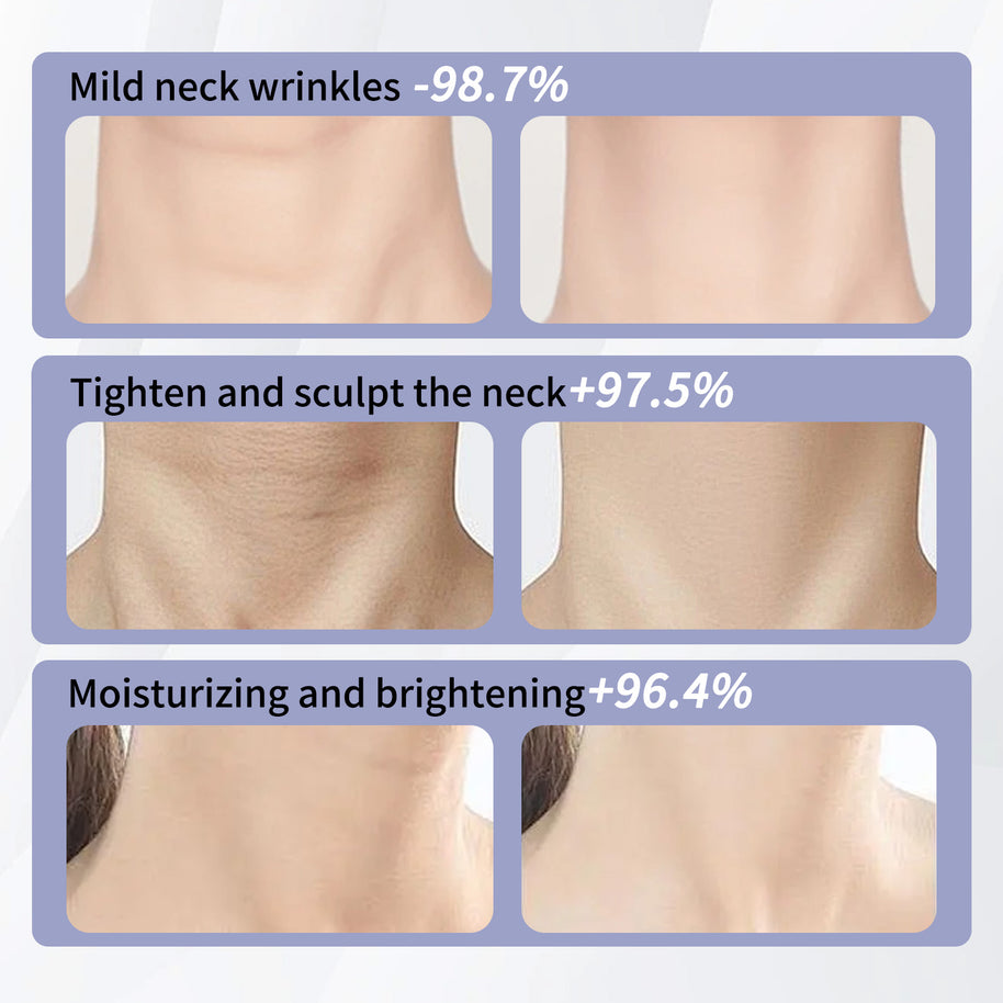 YILEST Anti-Aging Neck Firming Cream - HaiyiBeauty