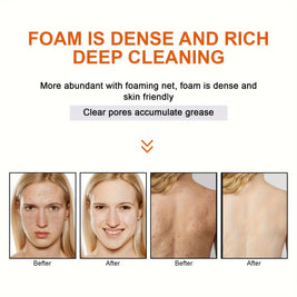 LUNOONK Kojic Acid Soap - HaiyiBeauty